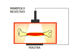 Tecar terapia funziona